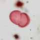 Spruce tree pollen.